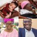 150,000 Sickle Cell Births Yearly: Experts Want FG to Make Screening of Newborn Babies Compulsory